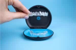 Μέθοδος Invisalign